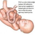 bebek katili PKK